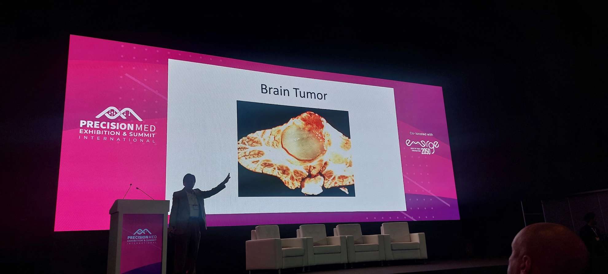 /assets/images/news/slider/3d-aaron-han-brain-tumor.webp